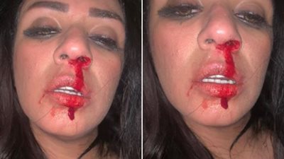 آخرهن شاهيناز .. فنانات تعرضن للضرب من أزواجهن (صور)