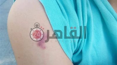 برلماني وراء تصالح أسرة طالب عذبه معلم بسبب الدروس الخصوصية (صور ومستند)