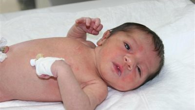 الإهمال الطبي يتسبب في بتر يد طفل وموته (صورة)