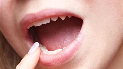 مفاجأة.. اللسان يشم الطعام ولا يتذوقه فقط!