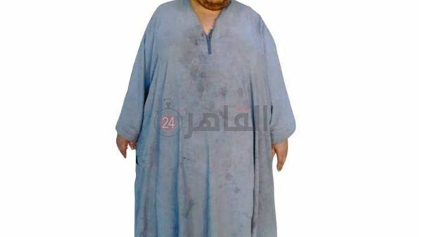 محمود يعاني من السمنة