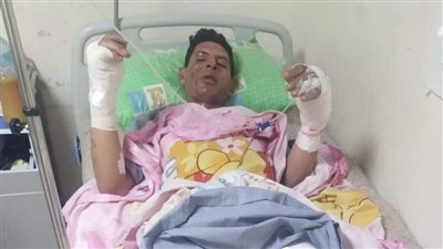أصيب بحروق من الدرجة الأولى.. عامل ينقذ أسرة من الحرق ببورسعيد وأسرته تطالب برعايته صحيًا