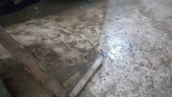 وحدة الغسيل الكلوي