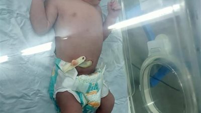 انتداب الطب الشرعي لتشريح جثة طفلة لقيطة سلمتها سيدتان لمستشفى الخانكة 