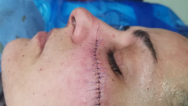 فتاة المحلة المجني