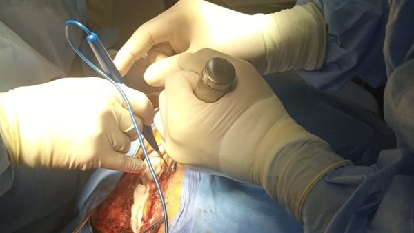 عملية جراحية 