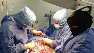 أنجبت توأمًا.. نجاح ولادة قيصرية لسيدة مصابة بكورونا في الغردقة