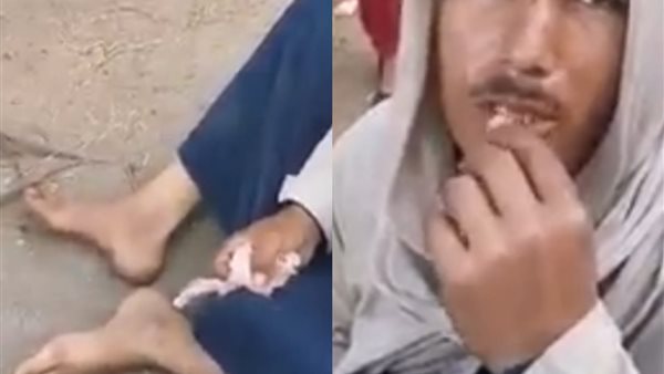 مستول أدعي الشلل