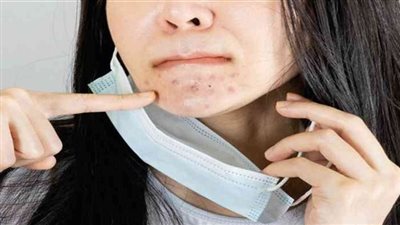 كيف تتخلص من حساسية الجلد الناتجة عن ارتداء الكمامة؟