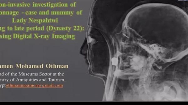 محاضرة عن الفحوصات