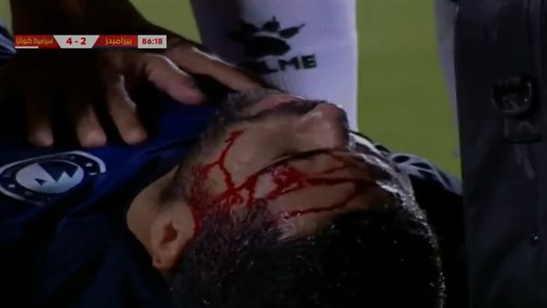 إصابة أحمد فتحي