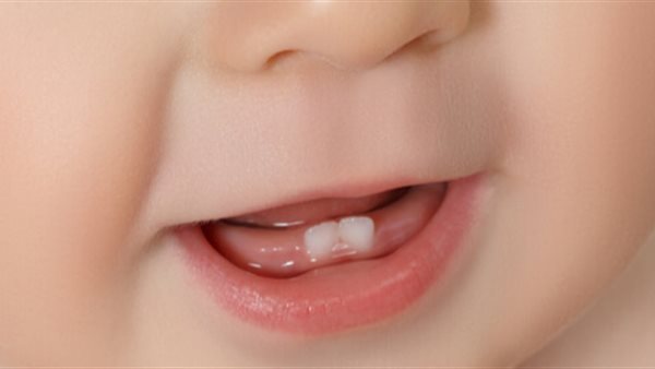 أسنان الأطفال 