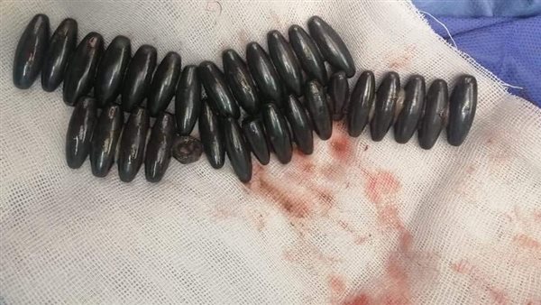 القطع المعدنية بعد