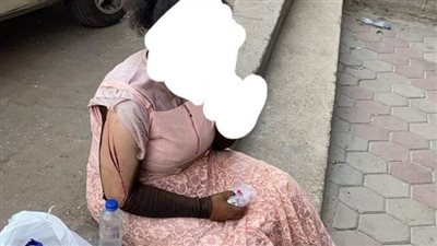مجموعة من الأشخاص يتعدون على فتاة بالأسلحة البيضاء في الجيزة (صور)