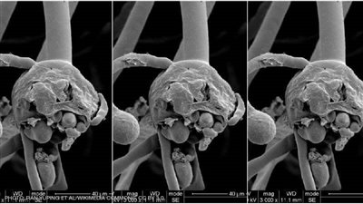 رئيس اللجنة العلمية لكورونا: لا يوجد سوى حالة أو اثنتين تم تشخيصها بالفطر الأسود في مصر