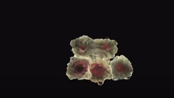 الخلايا السرطانية