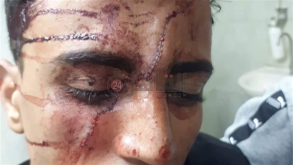 إصابة شاب بعد مشاجرته