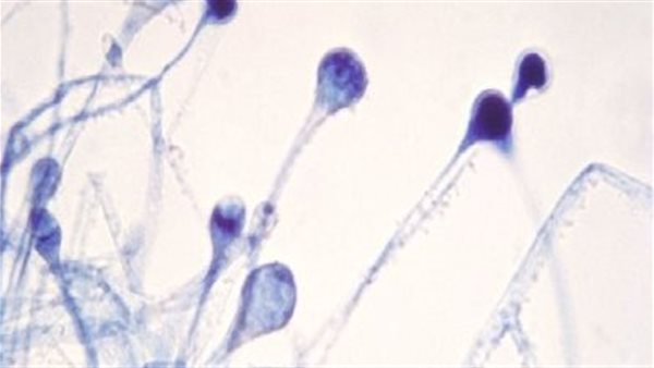 الفطر الأسود