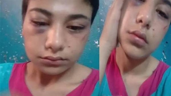 منة عبد العزيز