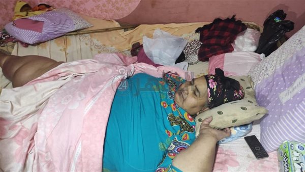 مريضة بداء الفيل