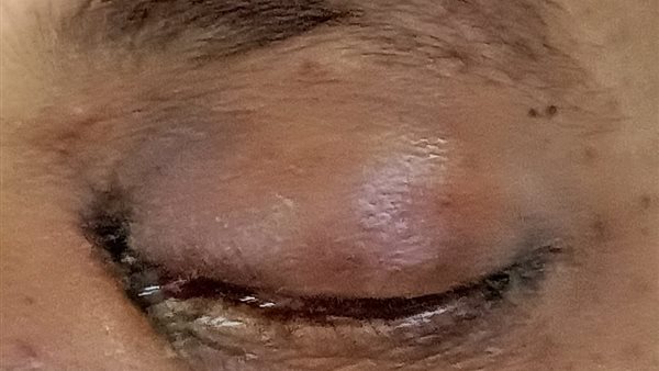 إصابة أحد أفراد أسرة