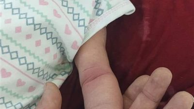 العثور على رضيع ملفوف بقطعة قماش بأحد شوارع الغردقة بالبحر الأحمر