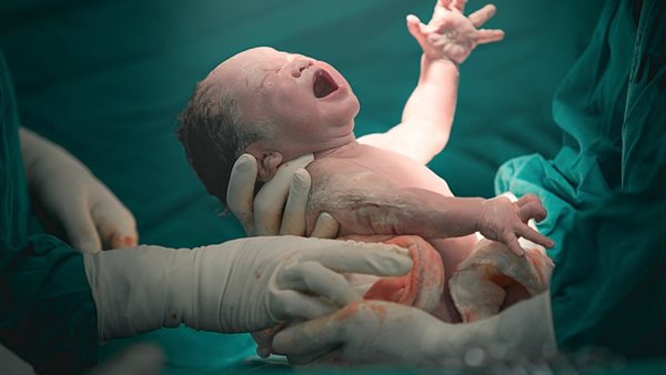 ولادة طفل