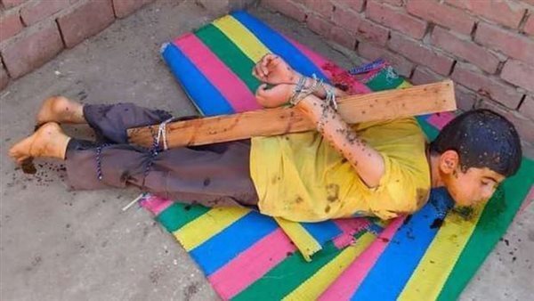 طفل التعذيب بالعسل