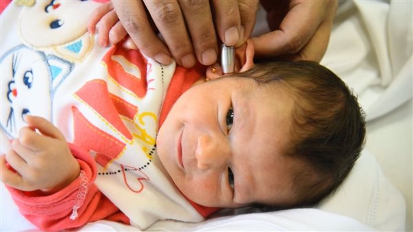 الفحص السمعي للأطفال