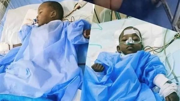 التوأم البوروندي