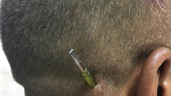 إخراج مفك من رأس