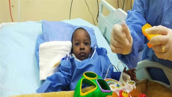 عملية فصل التؤام