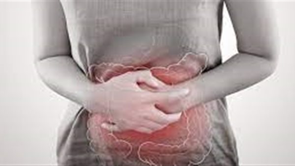 سرطان القولون -أرشيفية