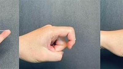 باحثون صينيون يصممون جلدًا للأطراف الصناعية يستشعر الكدمات (صور)