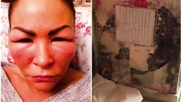 خبيرة التجميل بعد