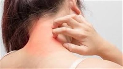 ارتفاع الإصابة بسرطان الجلد لدى الرجال بمعدل النصف خلال 10 سنوات ببريطانيا (دراسة)