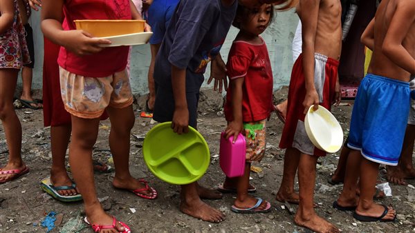 سوء التغذية