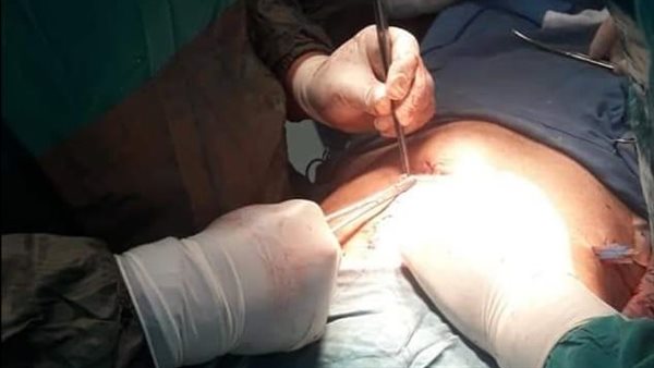 إجراء عملية جراحية