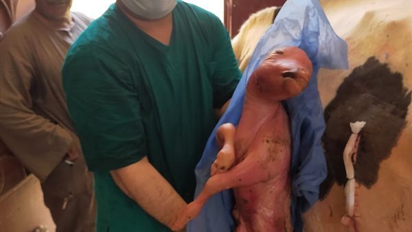 أول ولادة قيصرية