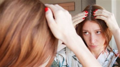 التقشير والنظام الغذائي.. نصائح أساسية للمساعدة في الحفاظ على صحة فروة الرأس