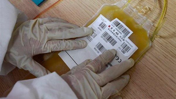 تصنيع البلازما 