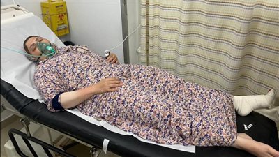 ميار الببلاوي عن إصابتها بالقدم: 