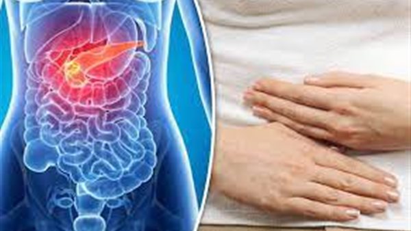 سرطان البنكرياس