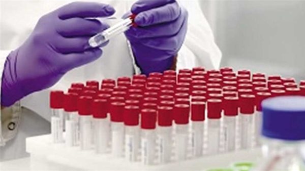 تحاليل pcr  فيروس