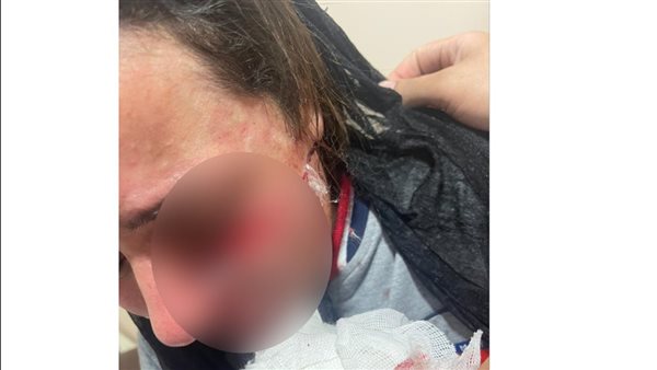 الفتاة الضحية