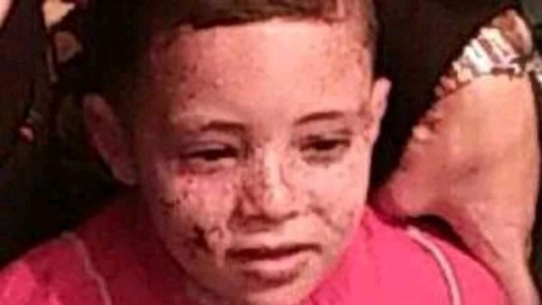 الطفل عمرو شميس