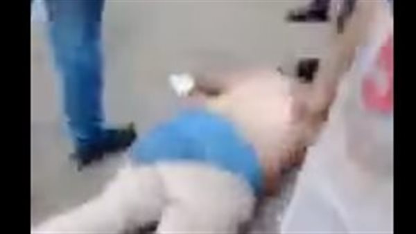 المواطن المصاب -