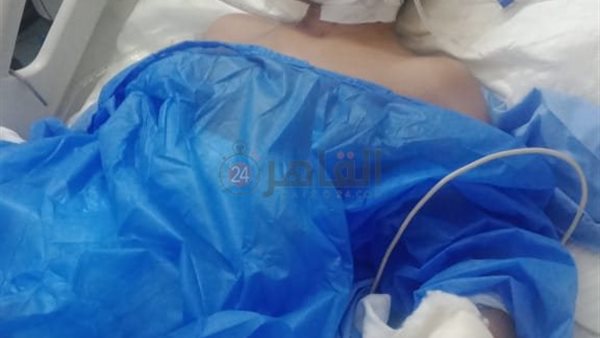 الطفل المصاب 