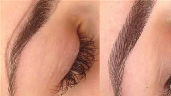 الميكروبليدنج - أرشيفية