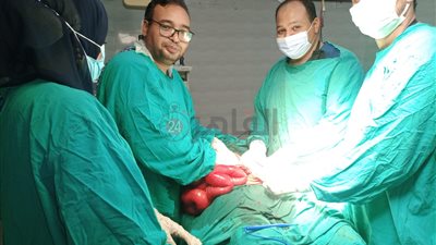 فريق طبي بقنا العام ينهي معاناة سيدة مصابة بانسداد معوي وورم بالقولون (صور)